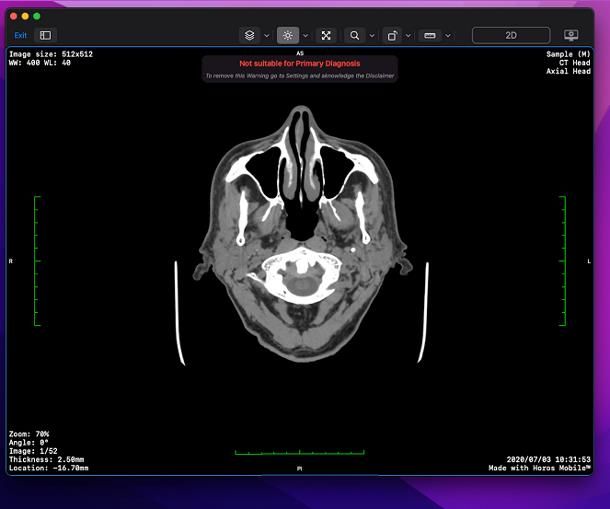 Come leggere CD radiografie su PC