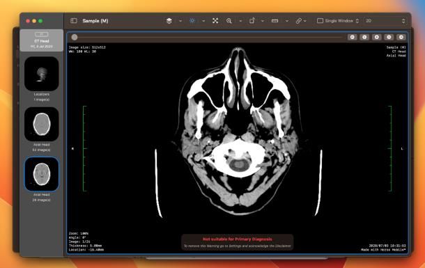 Come leggere CD radiografie su Mac