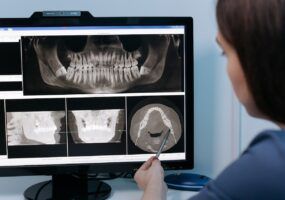 Come leggere CD radiografie su PC