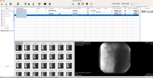 Come aprire file DCM