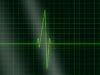 Come leggere ECG