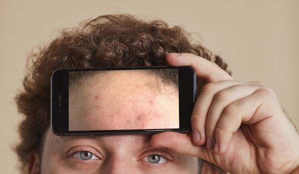 smartphone davanti alla fronte